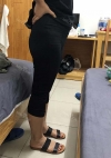 Thigh Liposuction+Calf Botox — Korea cost, reviews & before-after | MISOODA