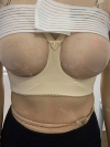 Motiva Breast Surgery at MBW — Korea cost, reviews & before-after | MISOODA