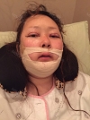 Two-Jaw Surgery & V-Line, Cinderella Circle Eye Surgery, Rhinoplasty, Lifting — Korea cost, reviews & before-after | MISOODA