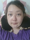 Two-Jaw Surgery & V-Line, Cinderella Circle Eye Surgery, Rhinoplasty, Lifting — Korea cost, reviews & before-after | MISOODA