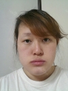 Two-Jaw Surgery & V-Line, Cinderella Circle Eye Surgery, Rhinoplasty, Lifting — Korea cost, reviews & before-after | MISOODA