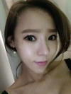Rhinoplasty & Double Eyelid Revision Surgery — Korea cost, reviews & before-after | MISOODA