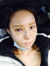 Rhinoplasty & Double Eyelid Revision Surgery — Korea cost, reviews & before-after | MISOODA