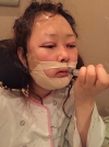Two-Jaw Surgery & V-Line, Cinderella Circle Eye Surgery, Rhinoplasty, Lifting — Korea cost, reviews & before-after | MISOODA
