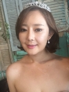 Two-Jaw Surgery & V-Line, Cinderella Circle Eye Surgery, Rhinoplasty, Lifting — Korea cost, reviews & before-after | MISOODA