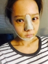 Rhinoplasty & Double Eyelid Revision Surgery — Korea cost, reviews & before-after | MISOODA