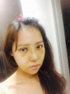 Rhinoplasty & Double Eyelid Revision Surgery — Korea cost, reviews & before-after | MISOODA