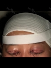 Girin: facial contouring, acculift, rhino, forehead lift, des, epi, fat graft — Korea cost, reviews & before-after | MISOODA