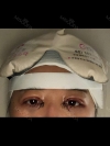Girin: facial contouring, acculift, rhino, forehead lift, des, epi, fat graft — Korea cost, reviews & before-after | MISOODA