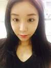 Eyes(non-incision+lateral cantho plasty+lower lateral cantho plasty)+fat graft, how could it be natural like? — Korea cost, reviews & before-after | MISOODA