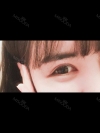 [Eyes surgery] Double eyelids plasty with incision, reoperation+upper cantho plasty+lateral cantho plasty+lower lateral cantho plasty — Korea cost, reviews & before-after | MISOODA