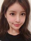 I got surgery at eyes, nose as reoperation and bon contour surgery, fat graft with Jewelry surgery center. — Korea cost, reviews & before-after | MISOODA