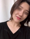 Nasal Bridge, Nasal Tip, Alar Base Resection — Korea cost, reviews & before-after | MISOODA