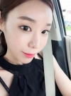 Eyes(non-incision+lateral cantho plasty+lower lateral cantho plasty)+fat graft, how could it be natural like? — Korea cost, reviews & before-after | MISOODA