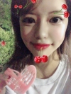 I got surgery at eyes, nose as reoperation and bon contour surgery, fat graft with Jewelry surgery center. — Korea cost, reviews & before-after | MISOODA