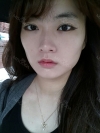 Eye, Nose, Micro Fat Grafting, Facial bone contouring surgery — Korea cost, reviews & before-after | MISOODA
