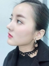 Rhinoplasty, PRP Fat Grafting — Korea cost, reviews & before-after | MISOODA