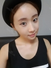 No longer spongebob look a like — Korea cost, reviews & before-after | MISOODA