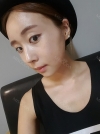 No longer spongebob look a like — Korea cost, reviews & before-after | MISOODA
