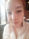 Operation : facial contouring (malar, chin, square jaw), nose — Korea cost, reviews & before-after | MISOODA