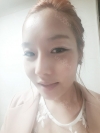Operation : facial contouring (malar, chin, square jaw), nose — Korea cost, reviews & before-after | MISOODA