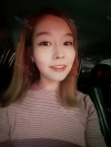 Operation : facial contouring (malar, chin, square jaw), nose — Korea cost, reviews & before-after | MISOODA