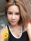 Full Face Fat Graft — Korea cost, reviews & before-after | MISOODA