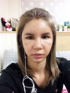 Full Face Fat Graft in Korea — Korea cost, reviews & before-after | MISOODA