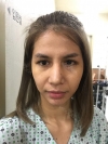 Full Face Fat Graft in Korea — Korea cost, reviews & before-after | MISOODA