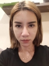 Full Face Fat Graft — Korea cost, reviews & before-after | MISOODA