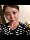 No regret with my decision! — Korea cost, reviews & before-after | MISOODA