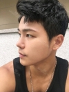 The typical Asian eyes — Korea cost, reviews & before-after | MISOODA