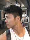 The typical Asian eyes — Korea cost, reviews & before-after | MISOODA