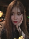 Double Eyelid + Rhinoplasty + Fat Graft + Facial Contour — Korea cost, reviews & before-after | MISOODA