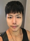 The typical Asian eyes — Korea cost, reviews & before-after | MISOODA
