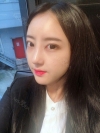 Double Eyelid + Rhinoplasty + Fat Graft — Korea cost, reviews & before-after | MISOODA
