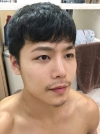 The typical Asian eyes — Korea cost, reviews & before-after | MISOODA