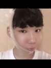 I feel good about myself — Korea cost, reviews & before-after | MISOODA