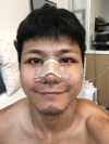 The typical Asian eyes — Korea cost, reviews & before-after | MISOODA
