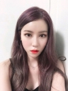 Double Eyelid + Rhinoplasty + Fat Graft + Facial Contour — Korea cost, reviews & before-after | MISOODA