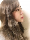 No regret with my decision! — Korea cost, reviews & before-after | MISOODA