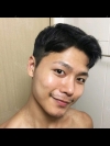 The typical Asian eyes — Korea cost, reviews & before-after | MISOODA