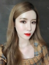 Double Eyelid + Rhinoplasty + Fat Graft + Facial Contour — Korea cost, reviews & before-after | MISOODA
