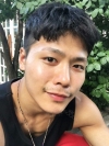 The typical Asian eyes — Korea cost, reviews & before-after | MISOODA
