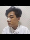Facial contour + Rhinoplasty + Double eyelid — Korea cost, reviews & before-after | MISOODA