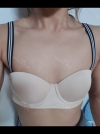 Life change with 325cc~ — Korea cost, reviews & before-after | MISOODA