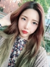 Eye surgery has succeeded in the way different image — Korea cost, reviews & before-after | MISOODA