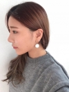 Eye surgery has succeeded in the way different image — Korea cost, reviews & before-after | MISOODA