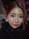 Eye surgery has succeeded in the way different image — Korea cost, reviews & before-after | MISOODA