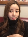 Goodbye button nose! — Korea cost, reviews & before-after | MISOODA